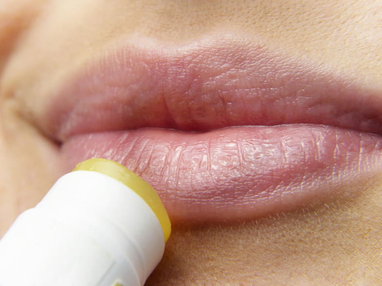 Rissige Lippen sind ein Symptom einer Nikotinallergie